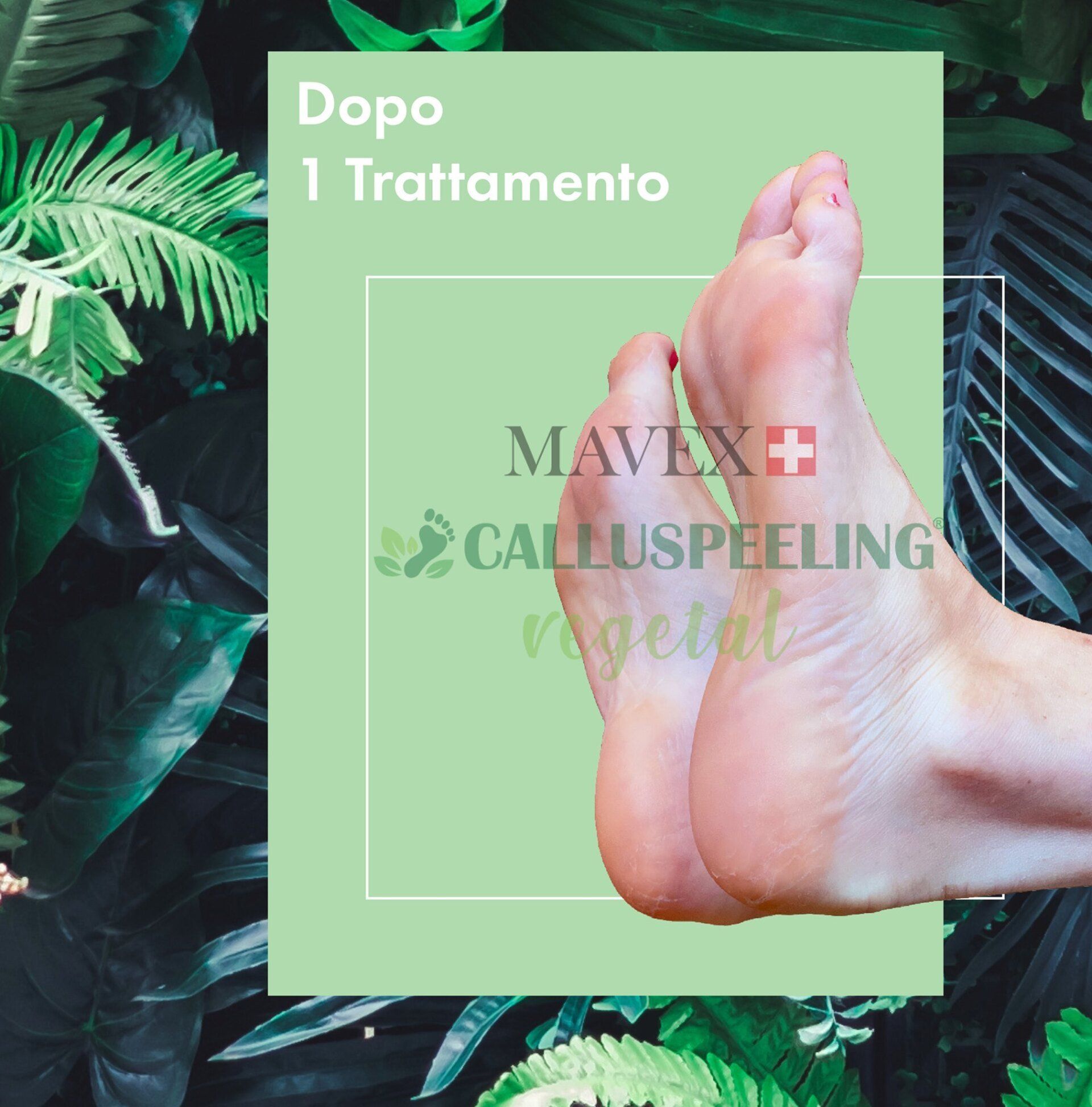 Linea Micoxan Mavex piedi